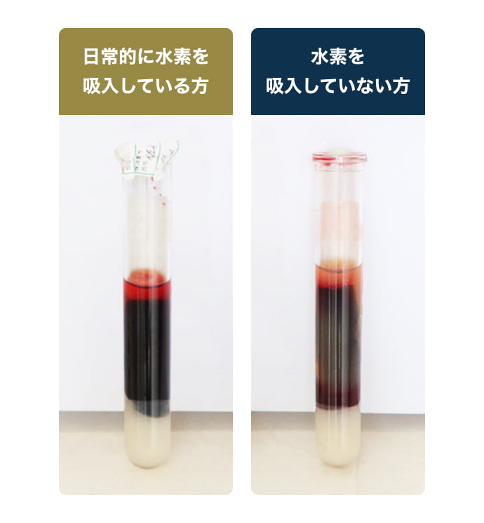 日常的に水素を吸入している方としていない方の血液の違い