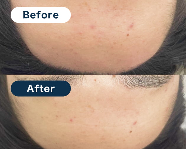 Before&After