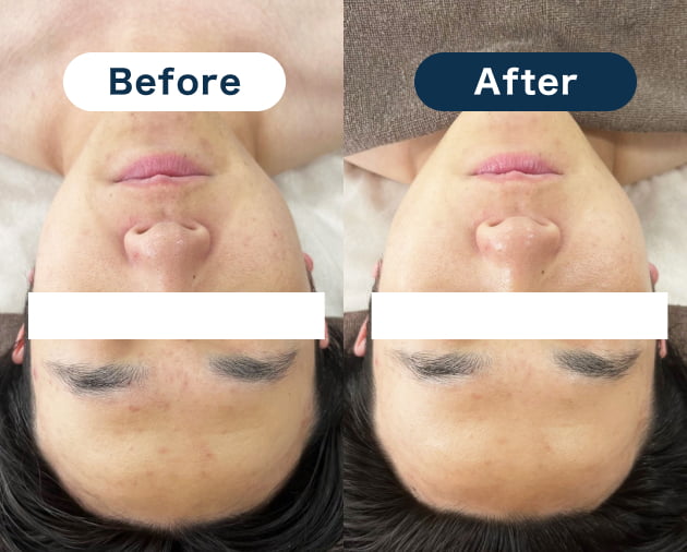 Before&After